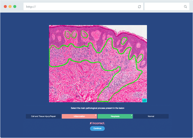 Histopathology Insight PALM, a product of Insight Learning Technology